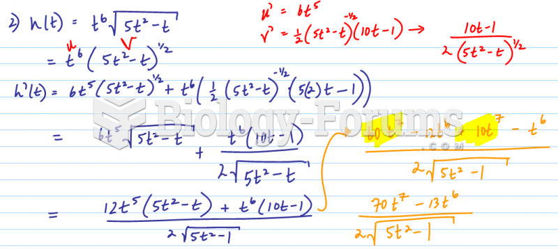 To find derivative us the chain rule