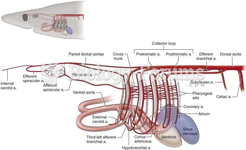 Circulatory System of a Shark