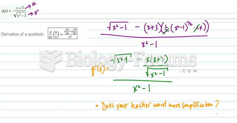 Find the derivative by using the quotient rule.