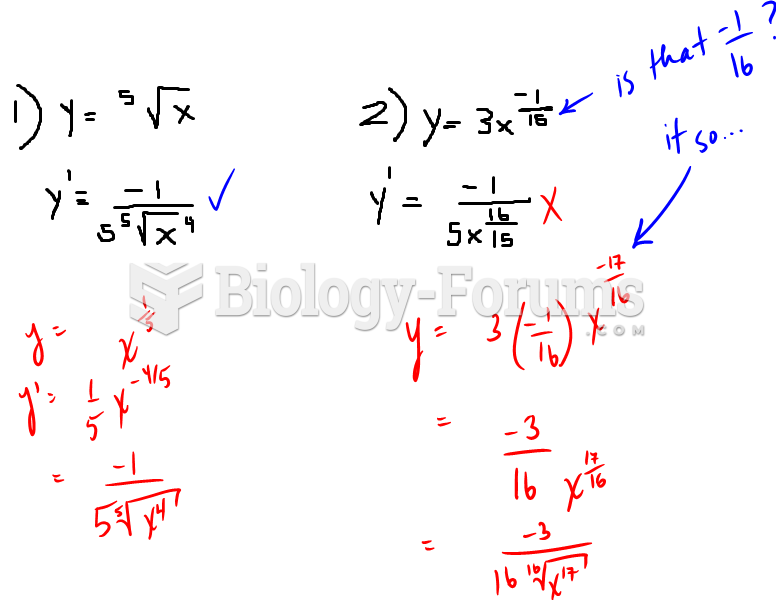 Are these the correct answers for finding the derivative using the power rule?