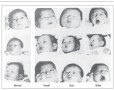 Steiner taste response experiments on three newborns