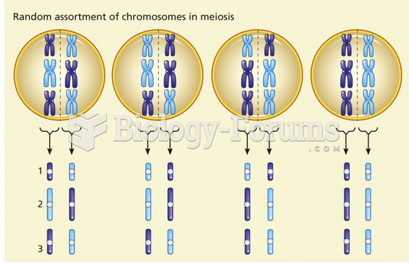 ) Random assortment of maternal (blue) and paternal (purple) chromosomes at metaphase