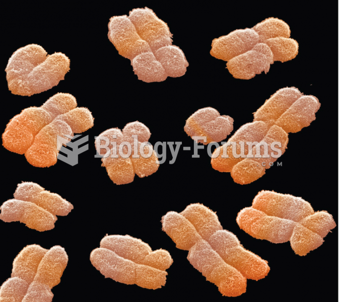 Replicated human chromosomes as seen by scanning electron microscopy