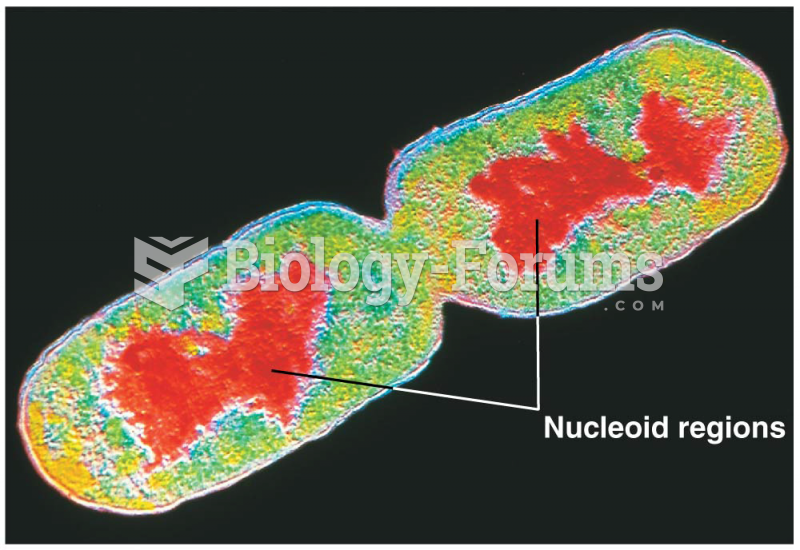 Color-enhanced electron micrograph of E. coli undergoing cell division