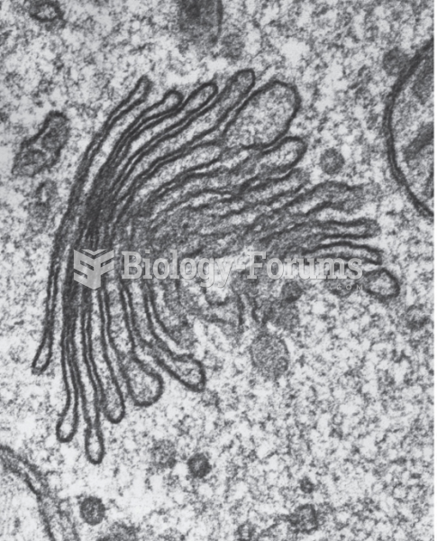 A transmission electron micrograph of the Golgi complex