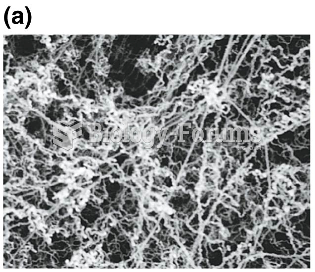 Chromatin fibers characteristic of the interphase nucleus