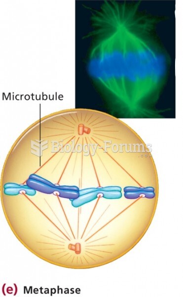 Stages of mitosis - Metaphase