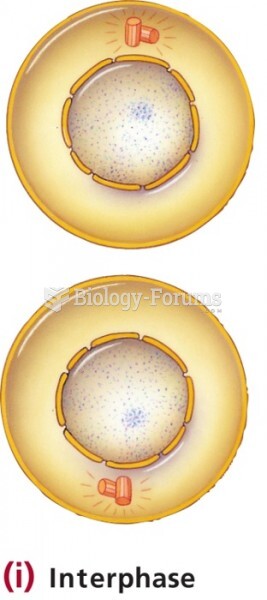 Stages of mitosis - Interphase