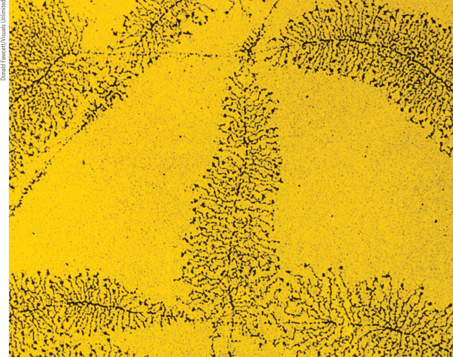 An electron micrograph showing transcription of a gene.