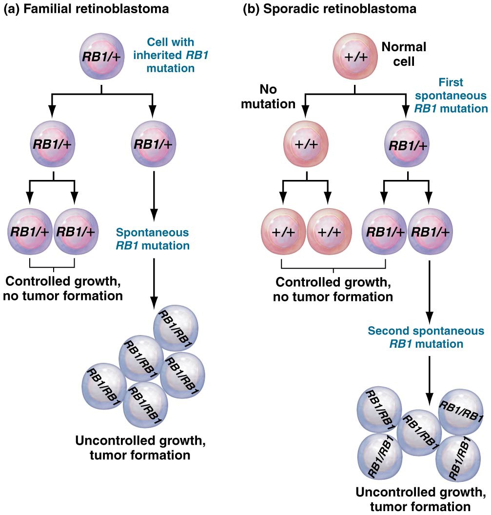 In familial retinoblastoma