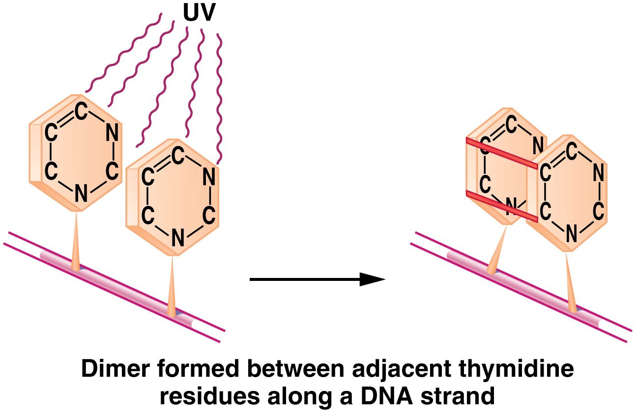 Induction of a thymine dimer by UV radiation, leading to distortion of the DNA