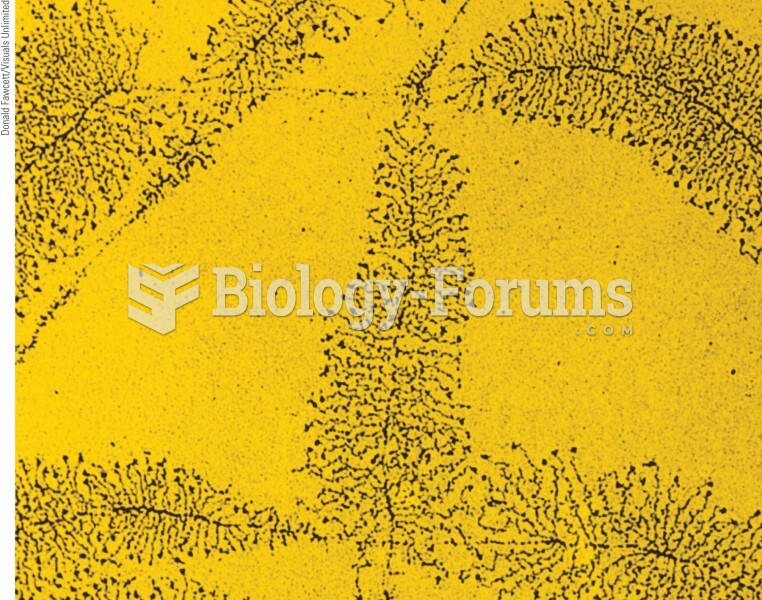 An electron micrograph showing transcription of a gene.