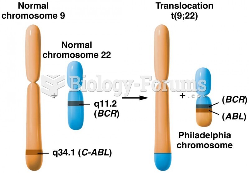 A reciprocal translocation involving the long arms of chromosomes
