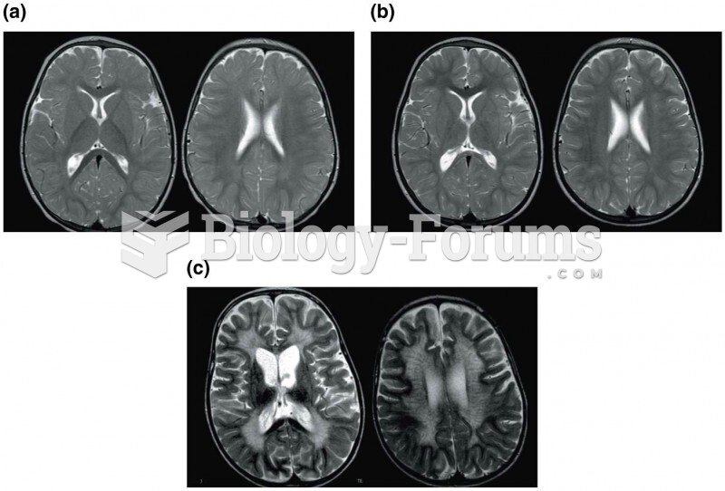 Gene therapy can prevent progression of metachromatic leukodystrophy