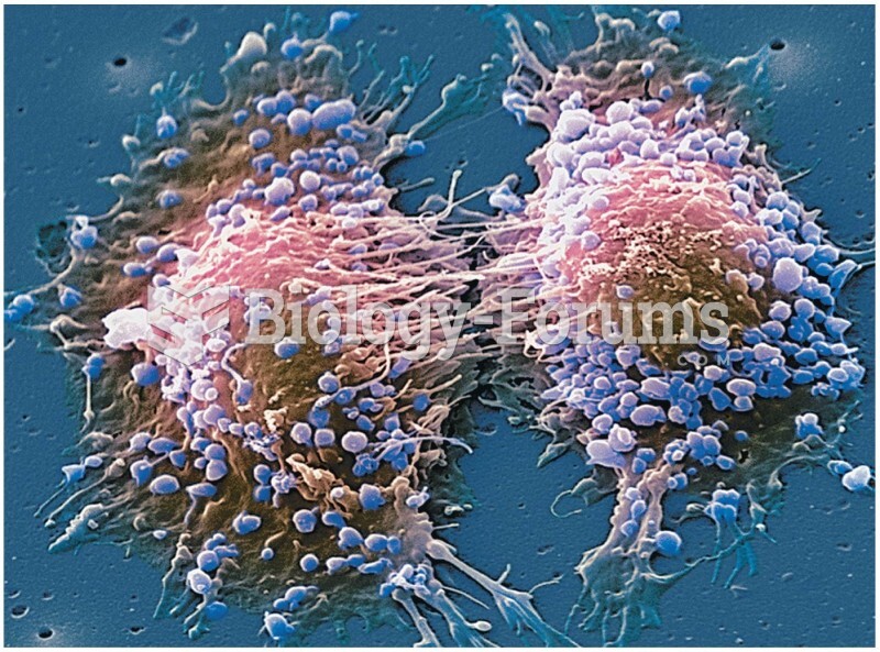 Opener Colored scanning electron micrograph of two prostate cancer cells in the final stages of cell