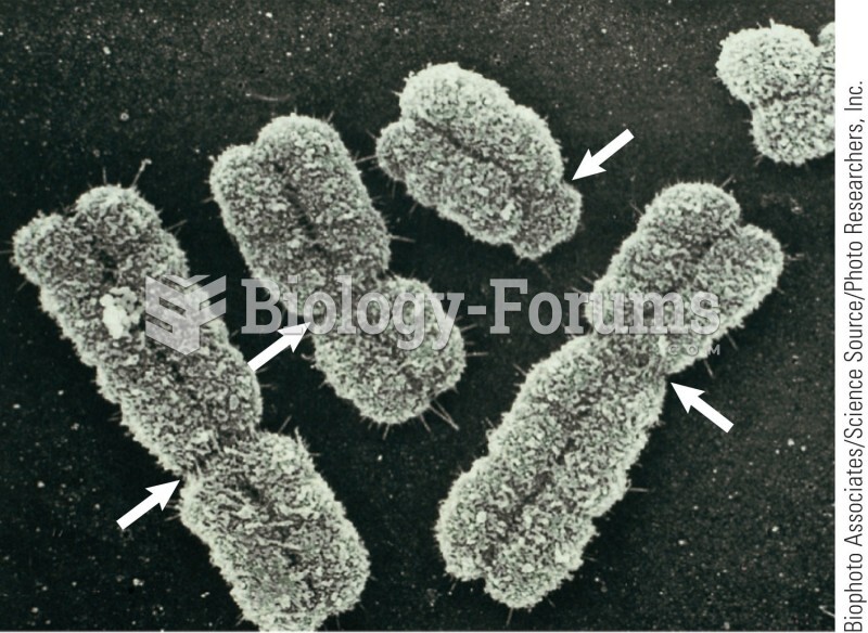 Human chromosomes as seen at metaphase of mitosis in the scanning electron microscope. The replicate