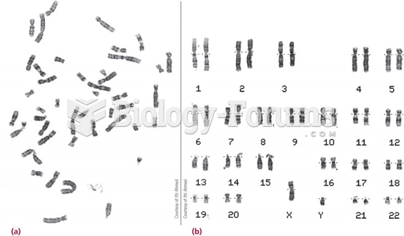 (a) A metaphase array of chromosomes as viewed in the microscope. (b) The computer-derived karyotype