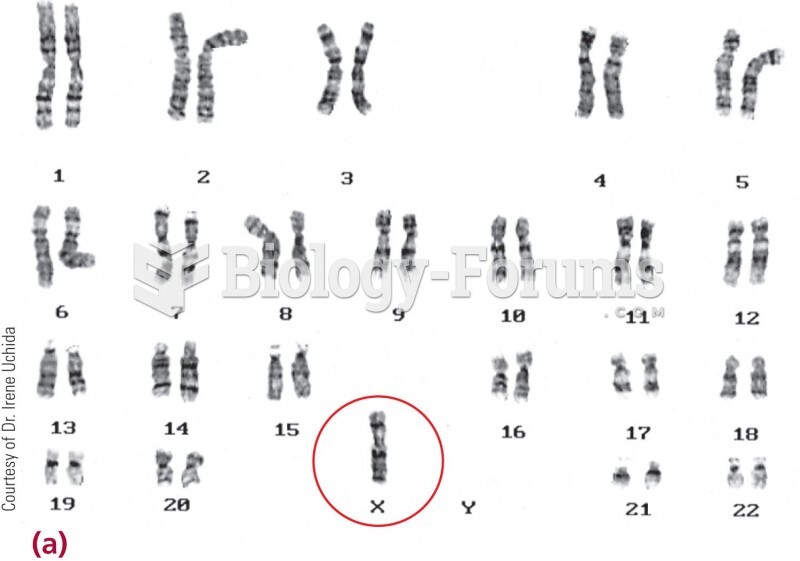 The karyotype of Turner syndrome. 