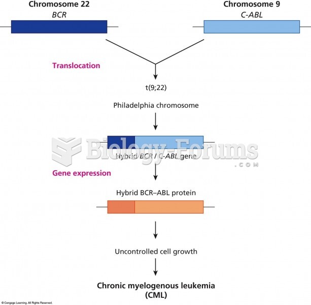 Gene fusion in the 9;22 translocation. Part of the BCR gene on chromosome 22 is moved to chromosome 