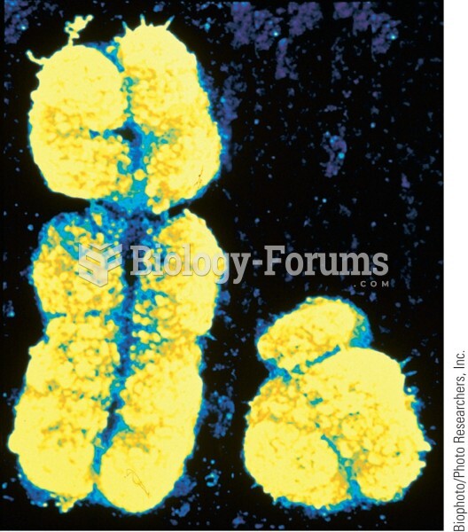 The human X chromosome (left) and the Y chromosome (right). This false-color scanning electron micro