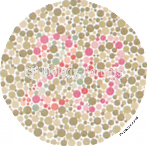 People with normal color vision see the number 29 in the chart; however, those who are color-blind c