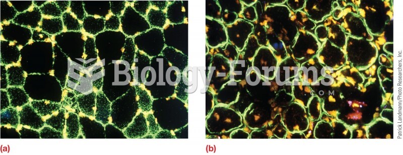 Distribution of dystrophin in muscle cells. (a) In normal muscle cells, all the dystrophin is locate