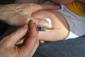 Vitamin K Injection at Birth