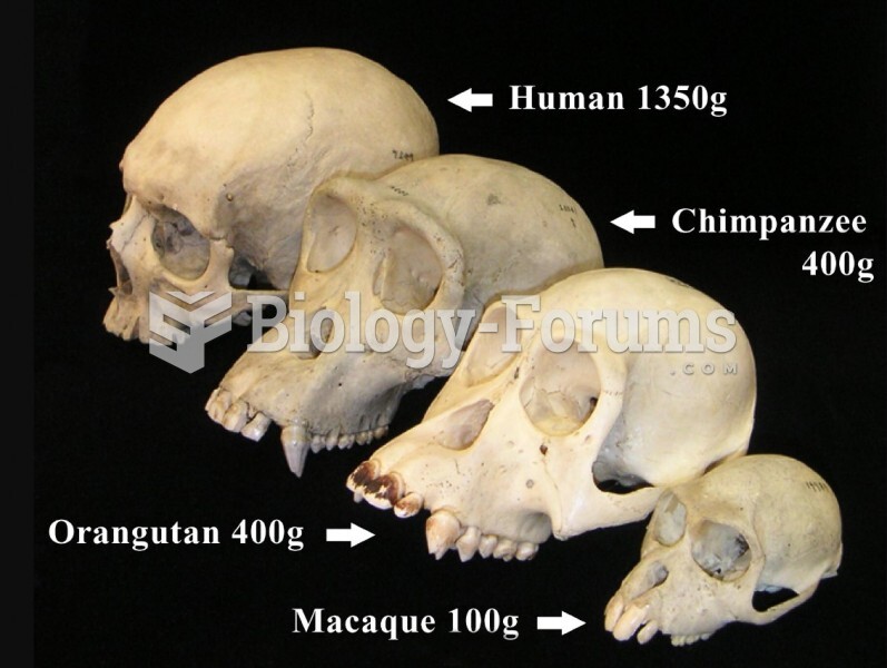 skull differences