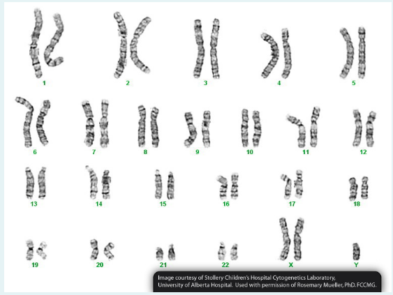 GENETICS DESCRIPTION