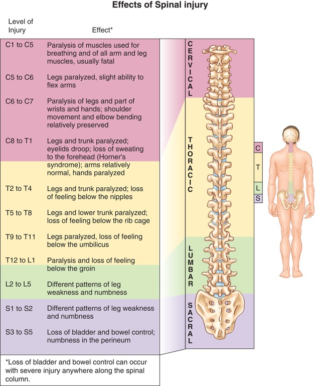 The Effects of a Spinal Cord Injury by Spinal Level