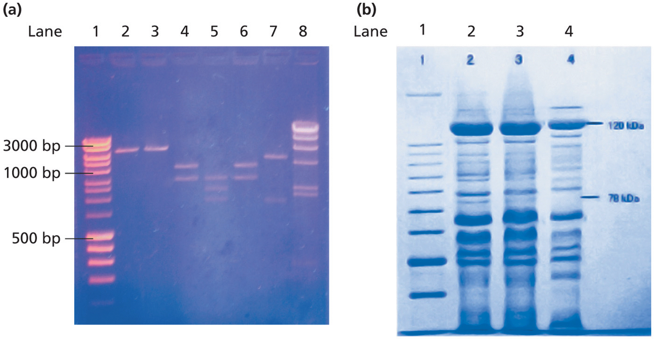 Visualization of nucleic acids and proteins in electrophoresis gels