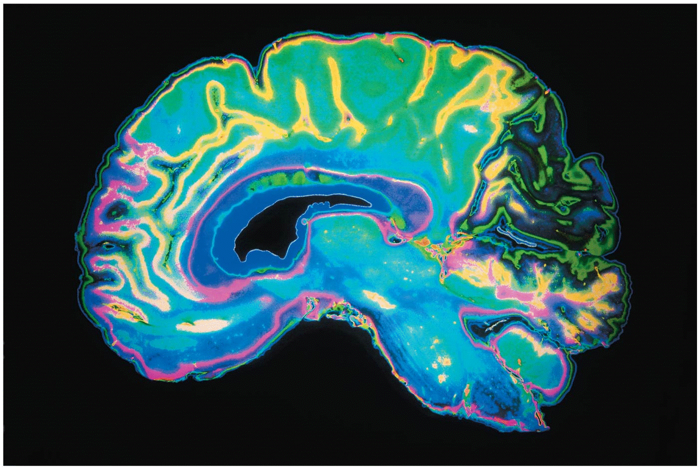 Opener A colorized cross section of the human brain