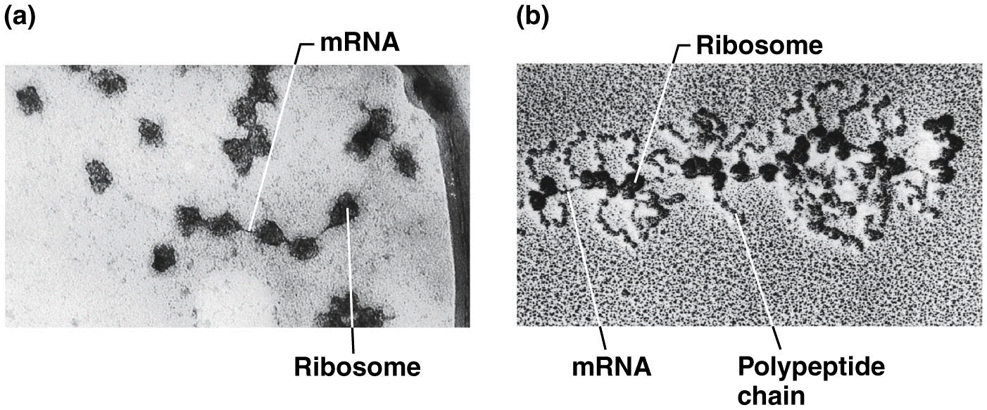 Polyribosomes as seen under the electron microscope