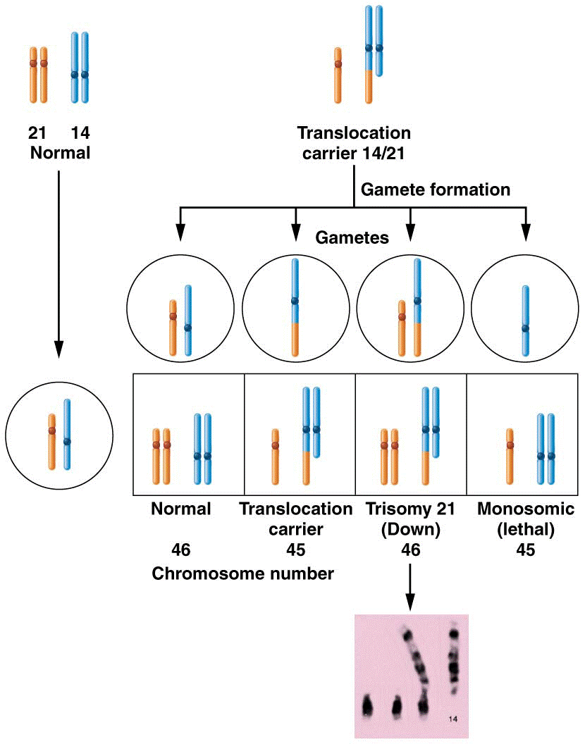 Chromosomal involvement and translocation in familial Down syndrome