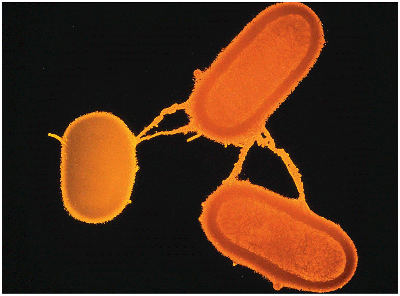 Opener Transmission electron micrograph of conjugating Escherichia coli