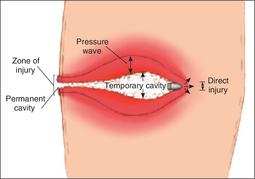 Projectile Passing Through Tissue