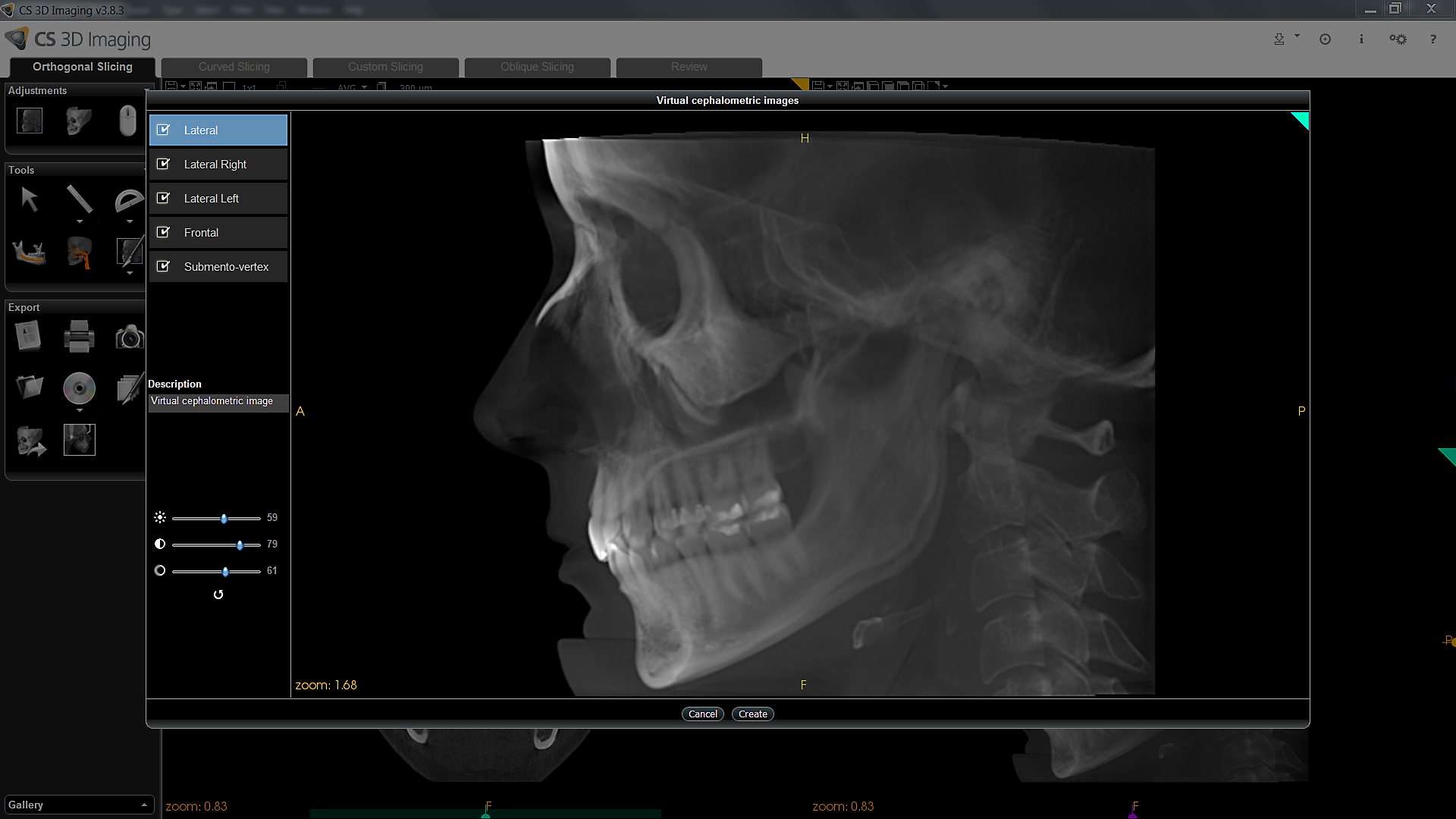3D imaging used in dentistry