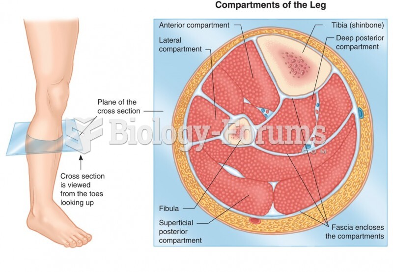 Compartment Syndrome