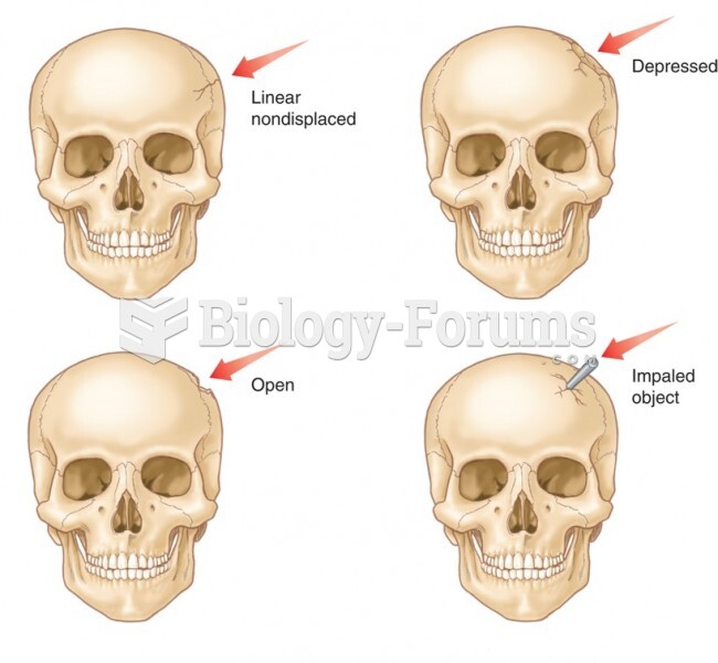 Various Types of Skull Fractures