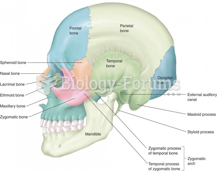 Bones of the Human Skull