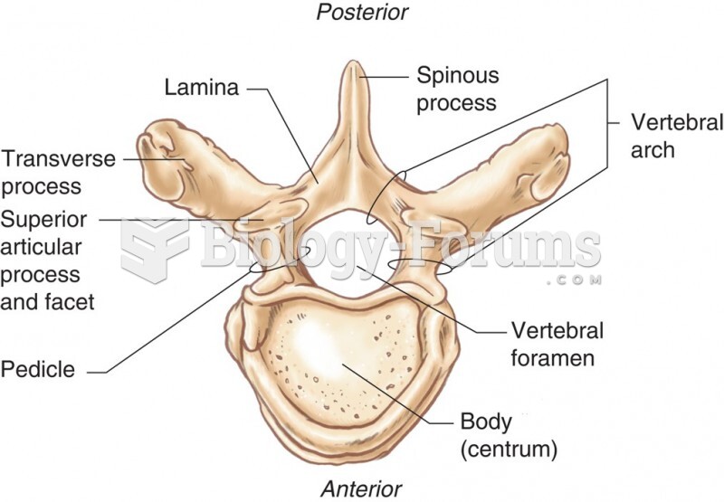 Structure of a Typical Vertebra (Superior View)