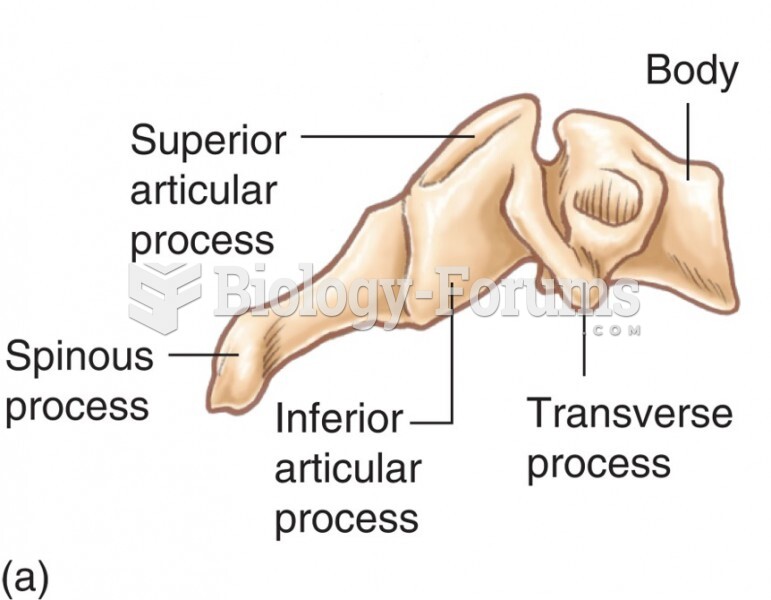 The Cervical Vertebrae: Right Lateral View of Vertebra