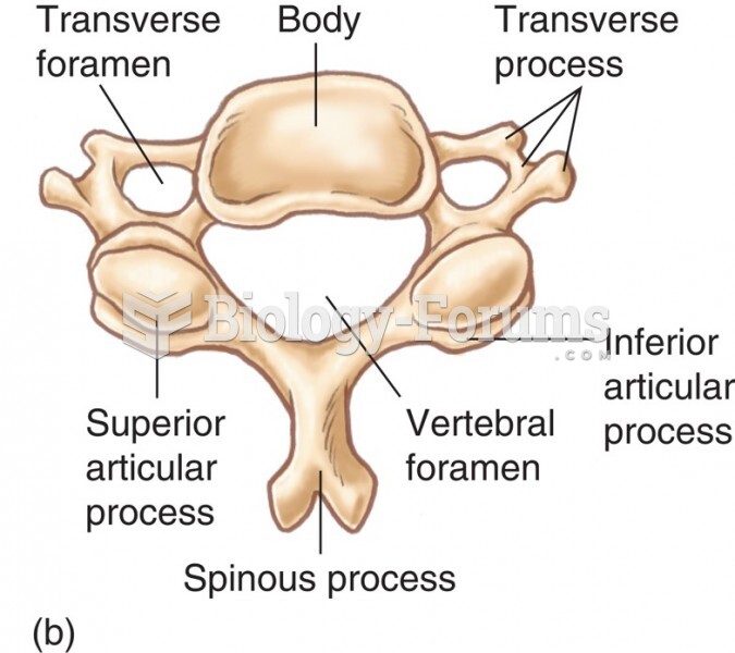 The Cervical Vertebrae: Superior View of Vertebra