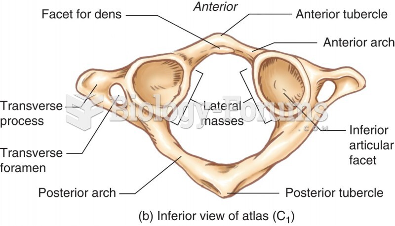 The Atlas Inferior View