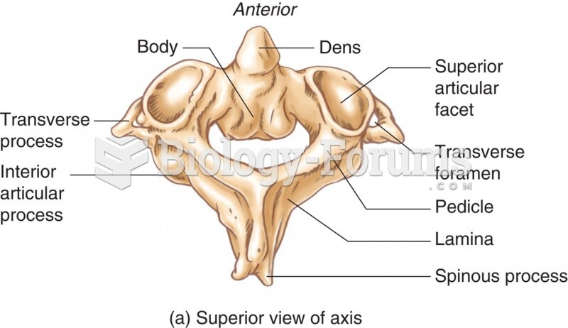 The Axis (Superior View)