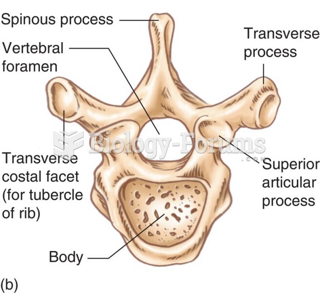 The Thoracic Vertebrae: Superior View of Vertebra