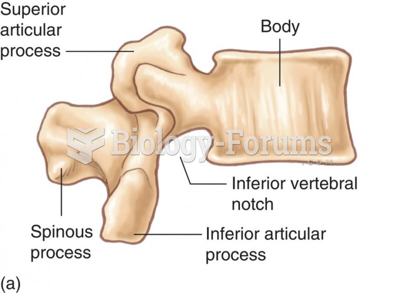 The Lumbar Vertebrae: Right Lateral View of Vertebra