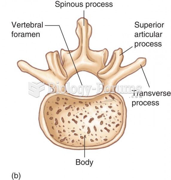 The Lumbar Vertebrae: Superior View of Vertebra