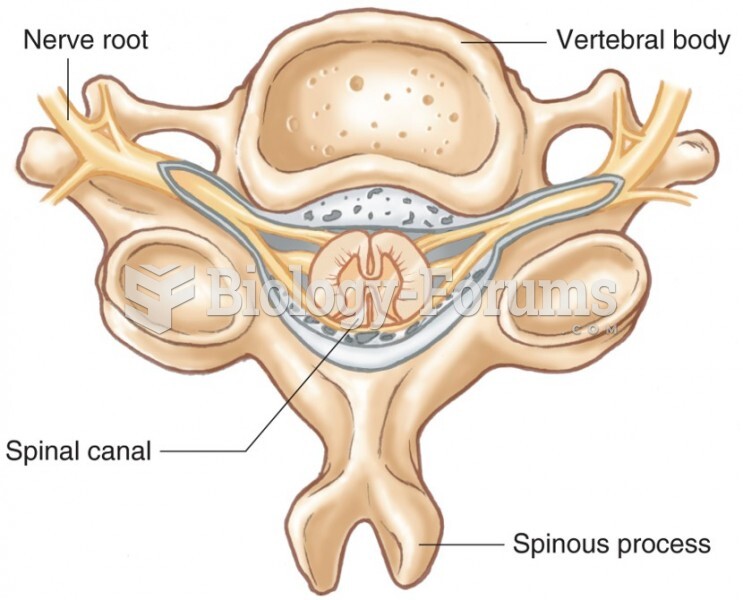 The Spinal Cord Is Protected by the Bony Structures of the Vertebrae. This Drawing of a Cervical Ver
