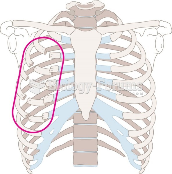 Flail Chest Occurs When Three or More Adjacent Ribs Fracture in Two or More Places